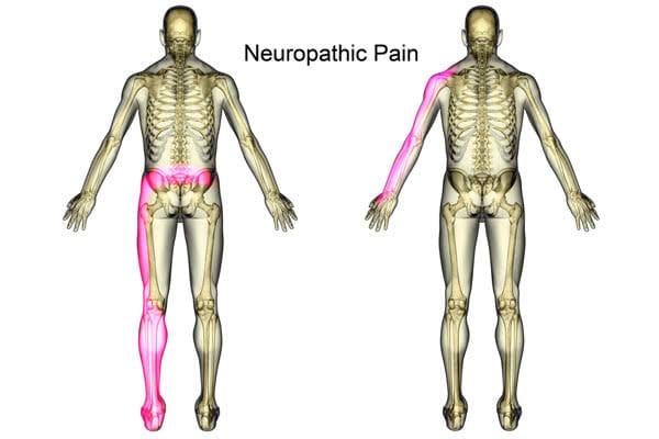Neuropathic Pain Market Trends, Growth Drivers, and Future Outlook 2032