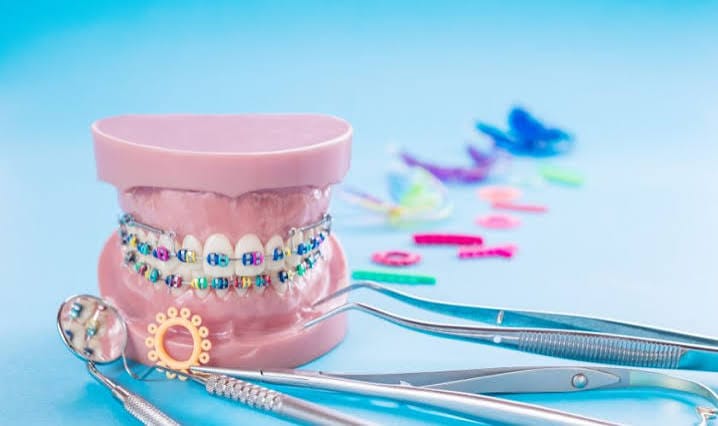 Orthodontic Market: Advancements in Braces, Aligners, and Dental Technologies