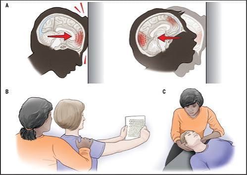 Traumatic Brain Injuries Treatment Market: Emerging Trends and Future Growth Opportunities