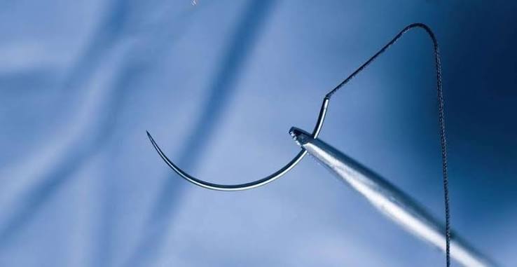 Suture Needles Market: Trends, Growth Drivers, and Future Outlook