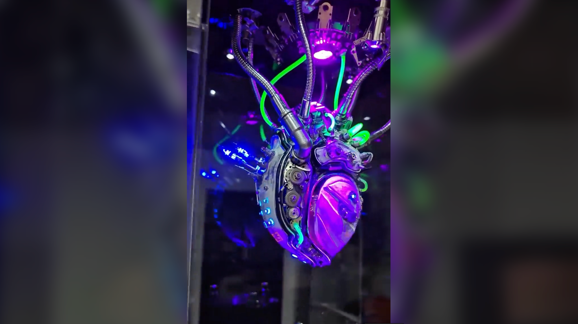 A Game-Changer in Heart Care: The Lifetime Mechanical Heart