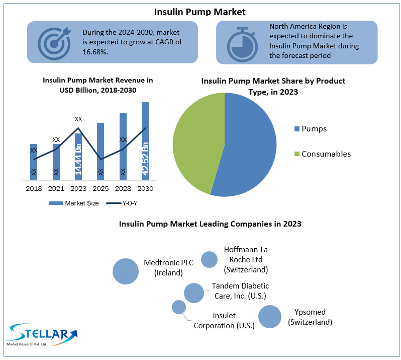 Insulin Pump Industry Development, Key Opportunities and Analysis of Key Players and forecast 2030