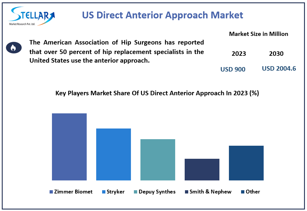 US Direct Anterior Approach Market Size, Forecasting Share and Scope for 2024-2030