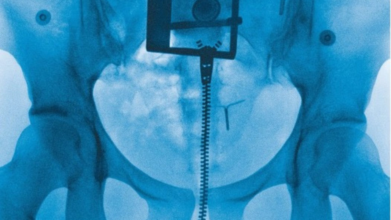 Album cover for Virgin: an x-ray of Lorde's pelvic area
