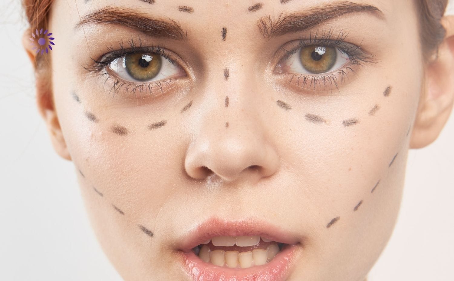 علاج شد الوجه بالخيوط في ألمانيا: تقنية متقدمة لإشراقة شبابية