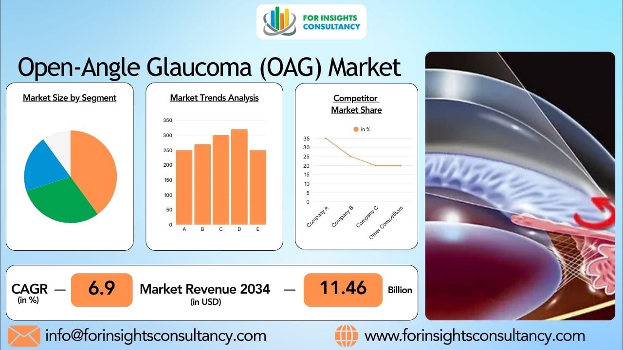 Open-Angle Glaucoma Market 2026: Technology and Drug Innovation Driving Growth