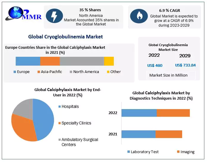 Cryoglobulinemia Exhibits a Stunning Growth by 2029