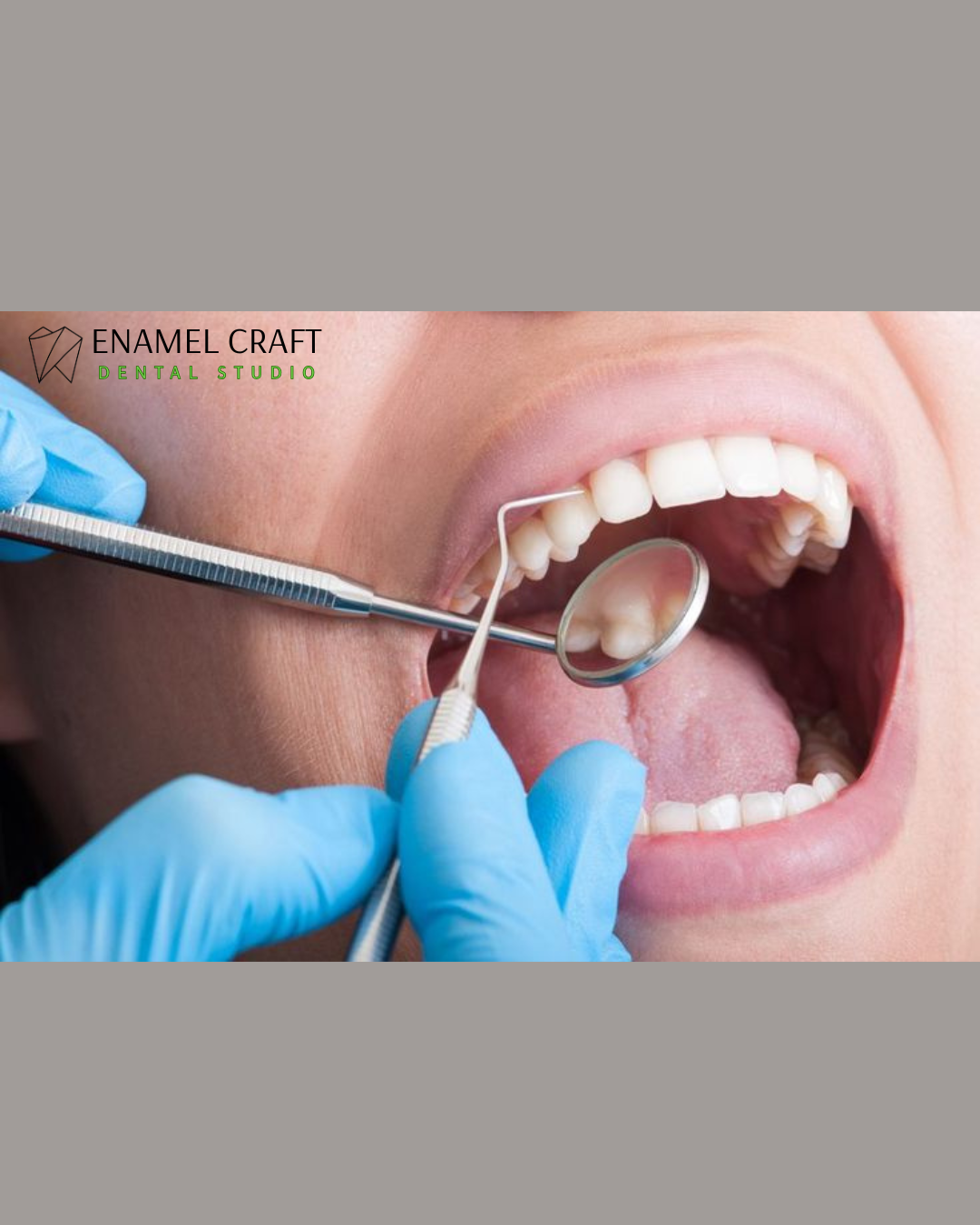 Catch Gum Issues Early- Trusted Dentist in Baner
