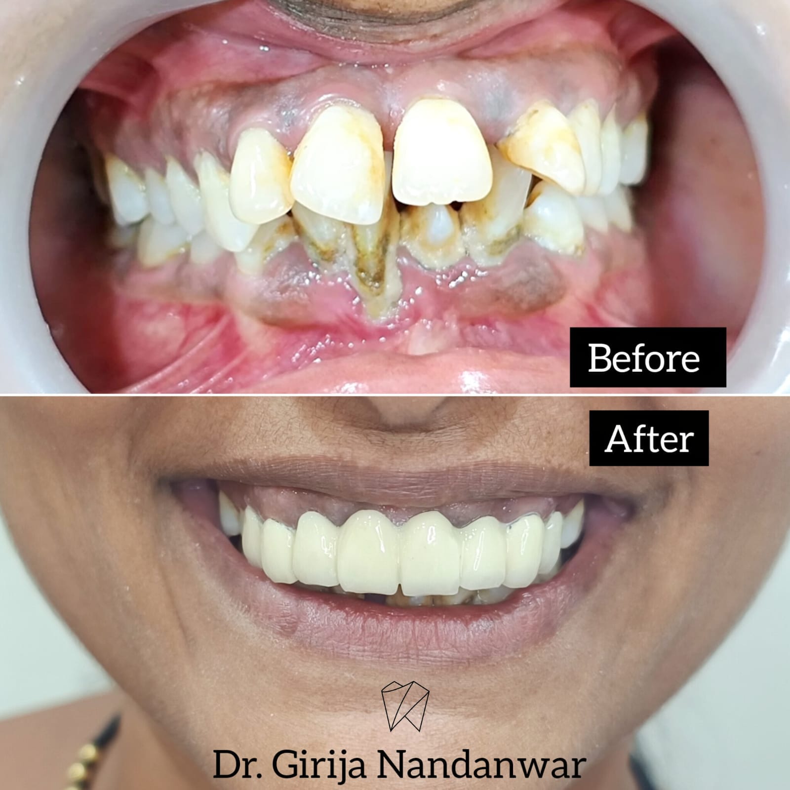 Case Discussion: Dental - Dentist in Pancard club road, Baner, Pune.