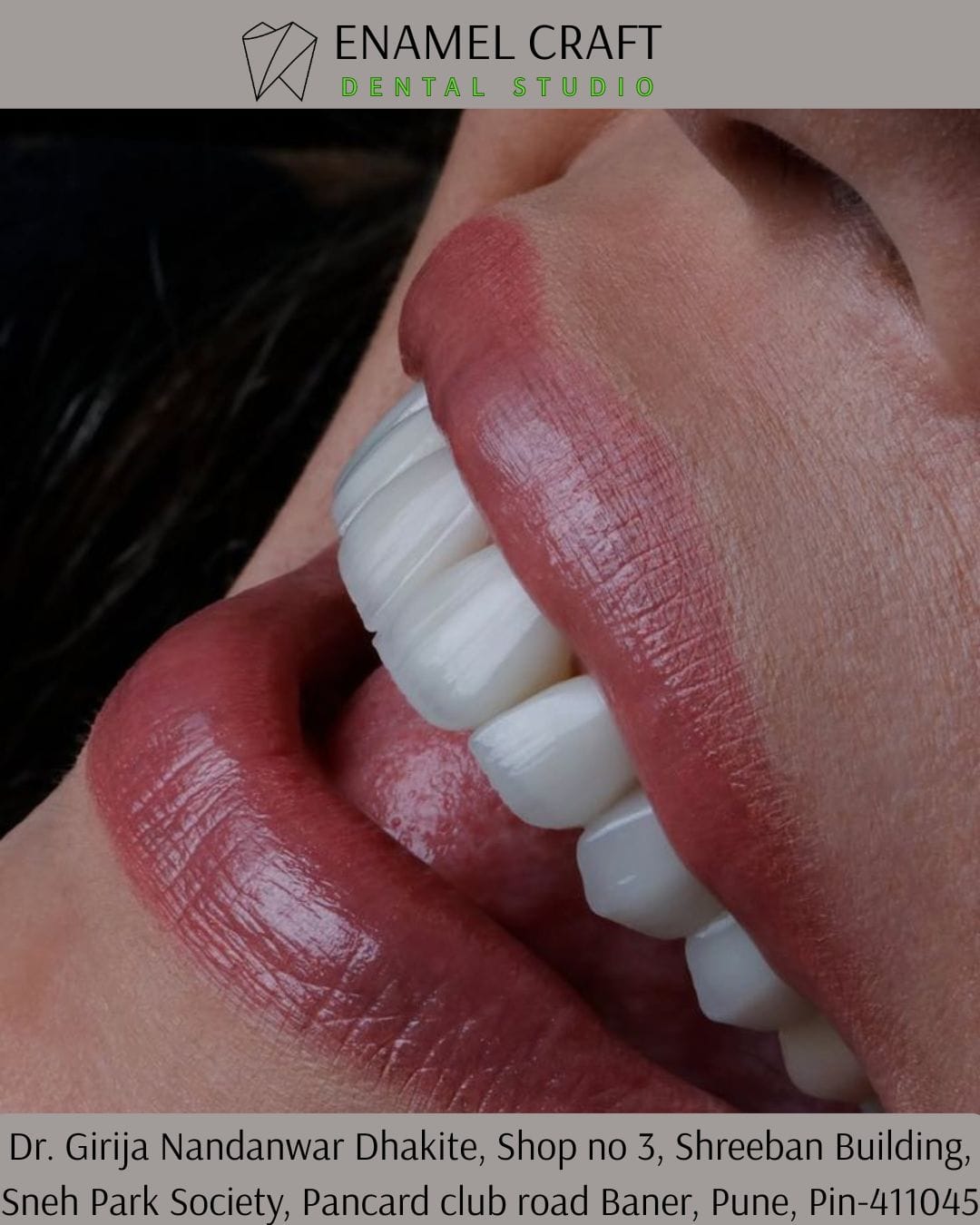 Teeth as Biomarkers for Hidden Disease-Dentist in Baner