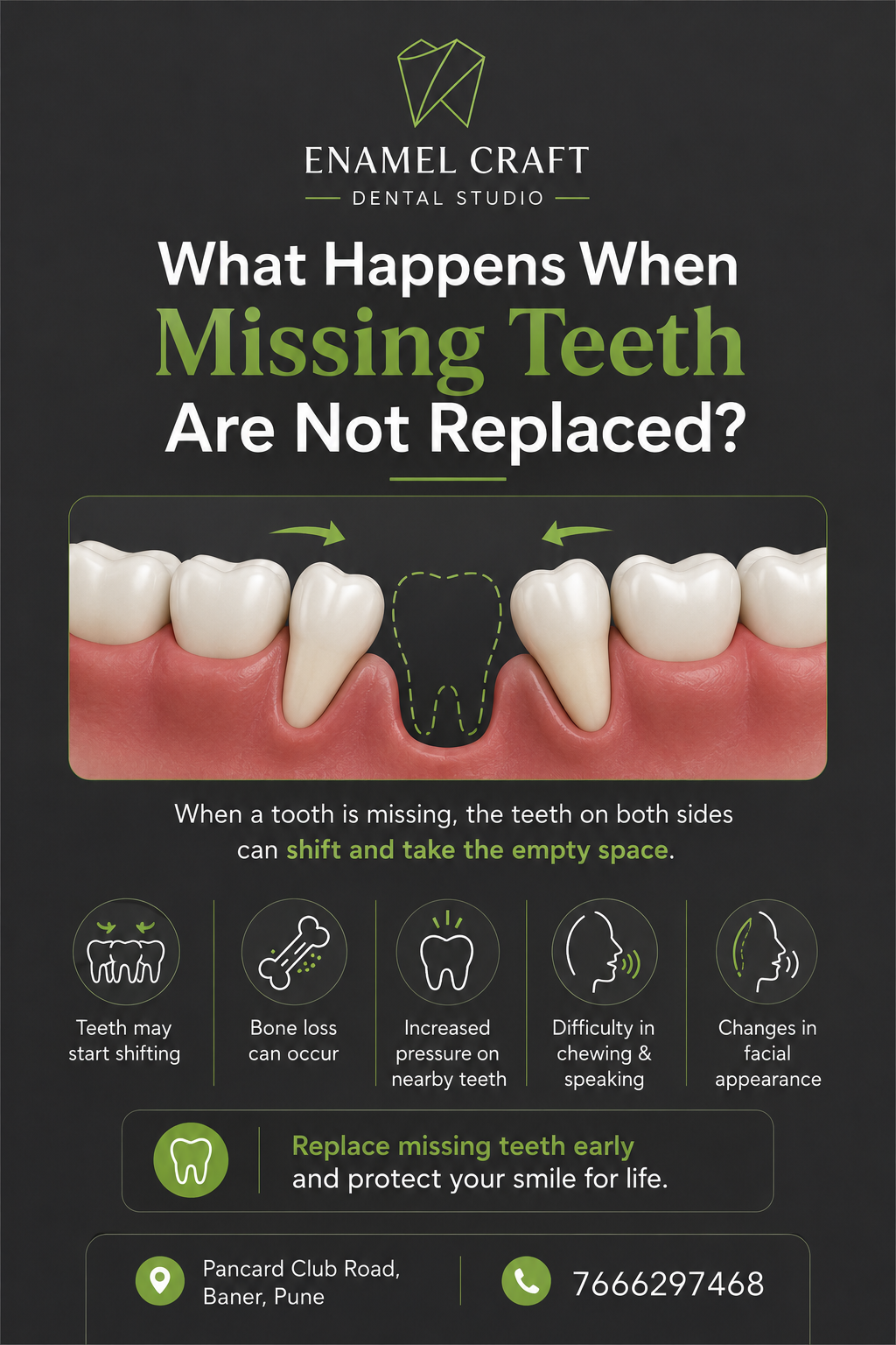 What Happens When Missing Teeth Are Not Replaced?