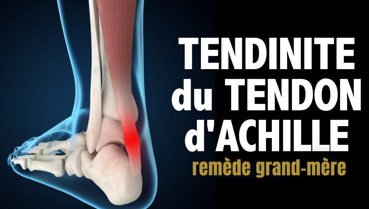 Tendinite tendon d'achille remède grandmère Tendinite tendon d'achille remède grandmère